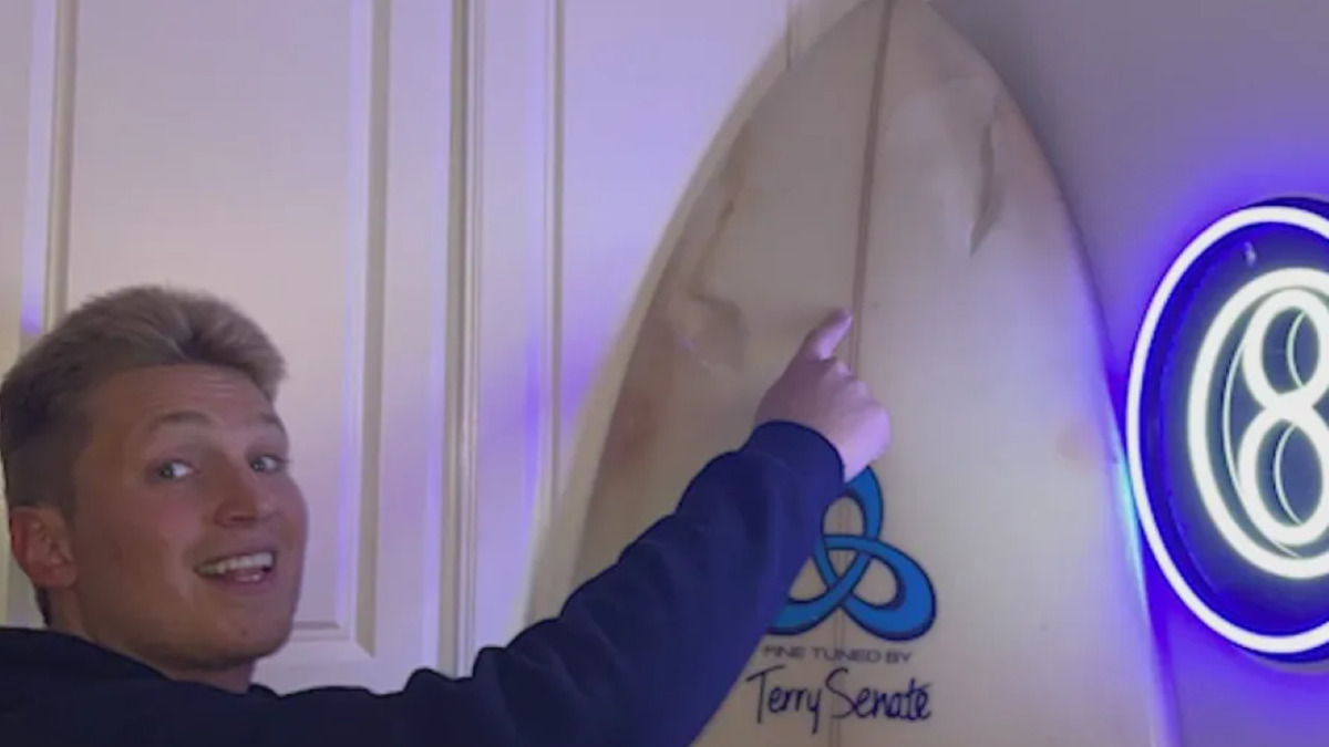 Shark attack victim smiling near board