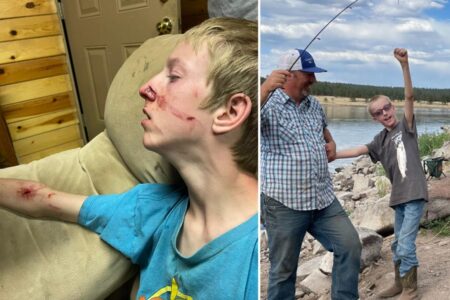 Bear mauls teen with rare disorder as he watched TV in Arizona cabin: ‘This is not normal’