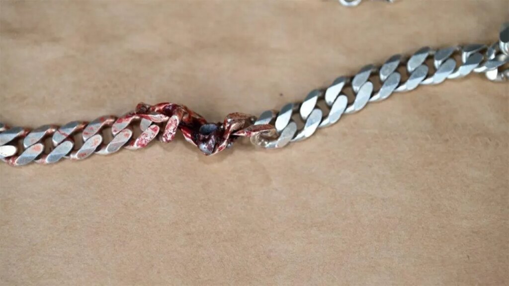 Unlikely item saves Colorado man’s life in shooting: ‘Likely the only reason’ he survived