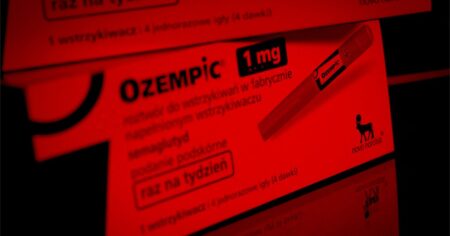 Using weight loss drugs beforehand can help