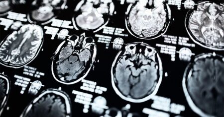 How MRI scans can help with diagnosis, treatments