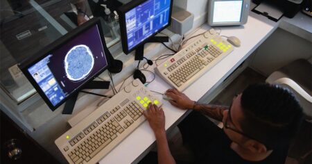 Biomarkers linked to disruption of blood-brain barrier