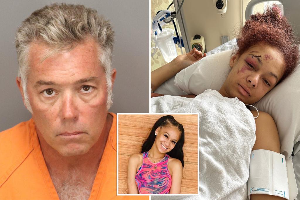 Florida man out on bail for pistol-whipping son laughed as he ran down woman during road rage incident: reports