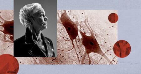 Can lowering cholesterol reduce Alzheimer’s, Parkinson’s risk?