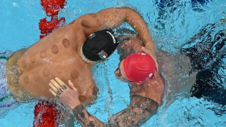 Benefits of Cupping: All About The Circular Marks Spotted on Olympians