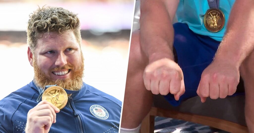 Olympic Gold Medalist Shows Off His Huge ‘Shot Put Hand’ That’s Much Bigger Than The Other
