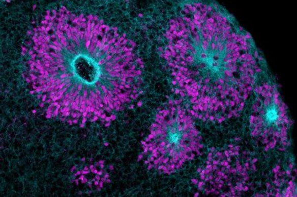 A brain organoid produced by the Children’s Medical Research Institute’s Stem Cell & Organoid Facility.