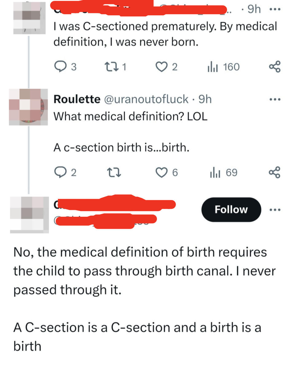 "I was C-sectioned prematurely; by medical definition I was never born"; "A c-section birth is birth," "No, the medical definition requires the child to pass through a birth canal"