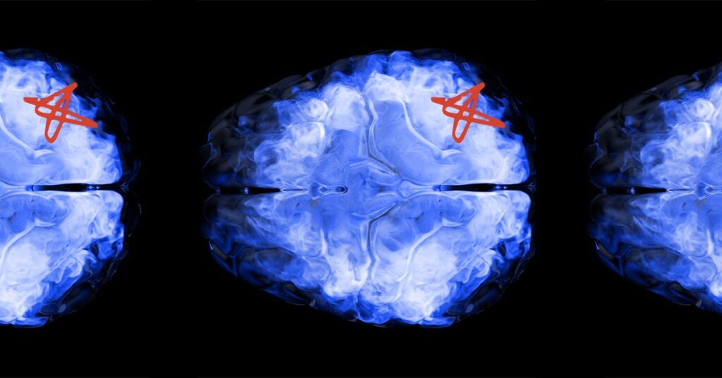 How does the brain clear ‘waste’ to protect itself?