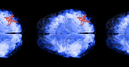 How does the brain clear ‘waste’ to protect itself?