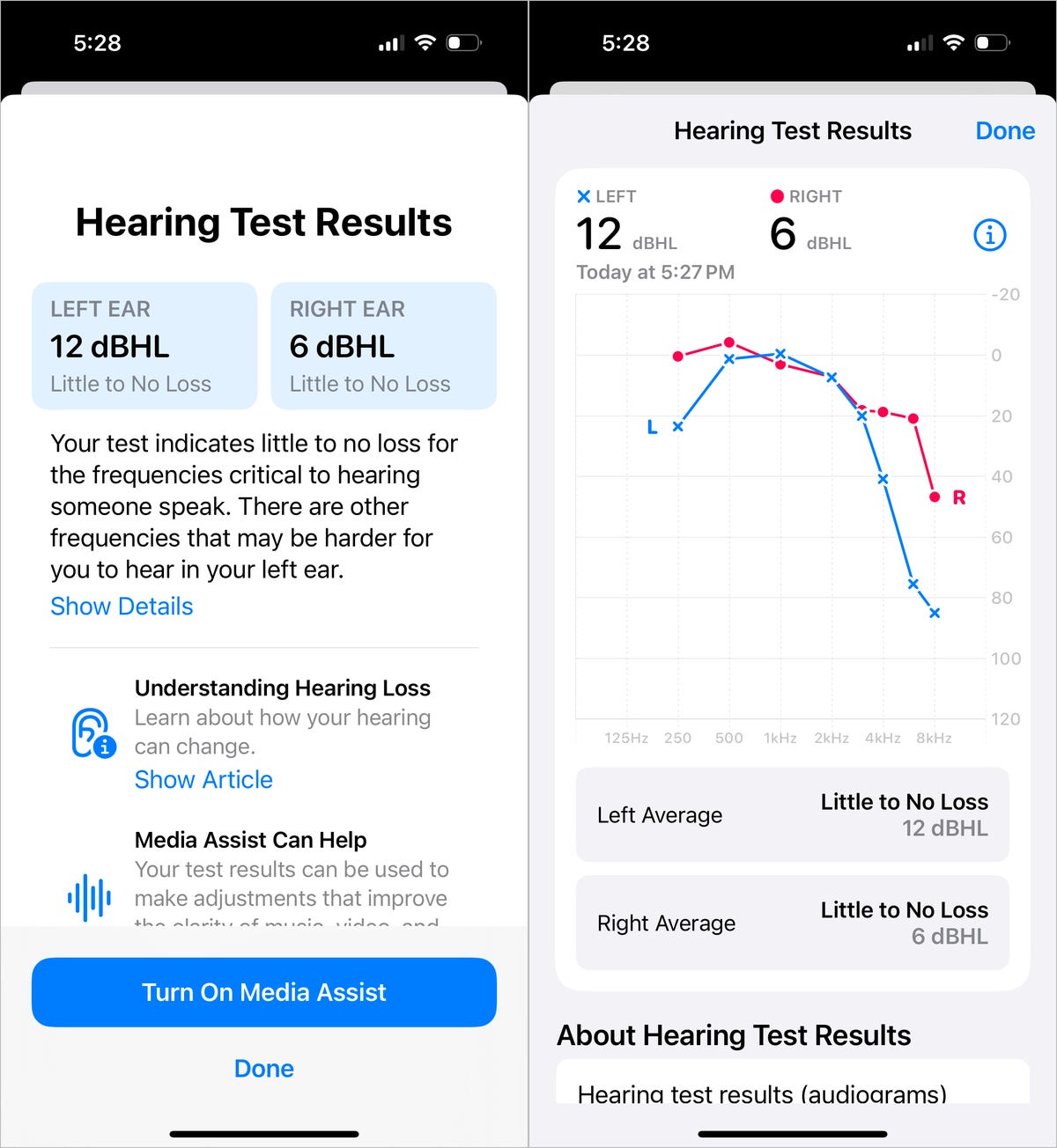 iPhone screenshots showing the hearing test: the dBHL numbers (left) and the graph of the frequencies (right).