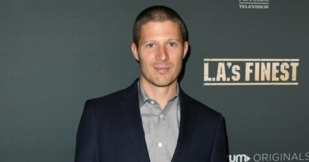Zach Gilford Shares Shocking Photos of Face After Health Scare: ‘So Yesterday Was Fun’