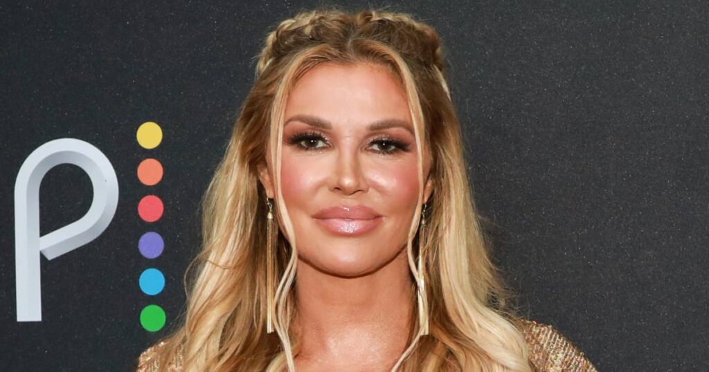 Brandi Glanville Says She Hasn’t Slept With Anyone in Over a Year Due to Facial Deformity