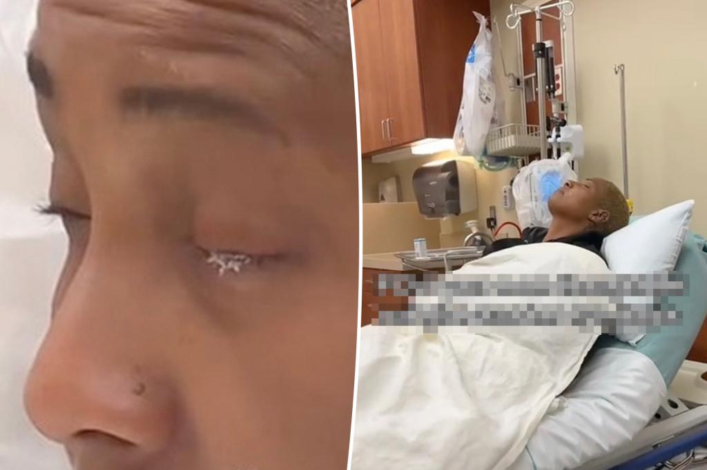 North Carolina mom mistakes nail glue for eyedrops, endures two months of ‘hell’