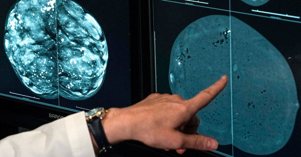 Opinion | The Pharmaceutical Industry Heads Into Elon Musk’s Wood Chipper