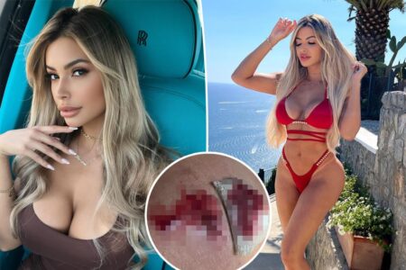 I paid nearly $6,000 for a ‘beauty chip’ to look hotter — years later, I’m still living with terrifying consequences