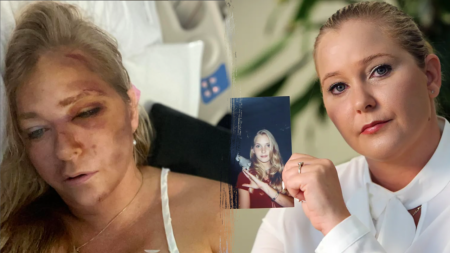 Jeffrey Epstein accuser Virginia Giuffre seriously injured after wreck