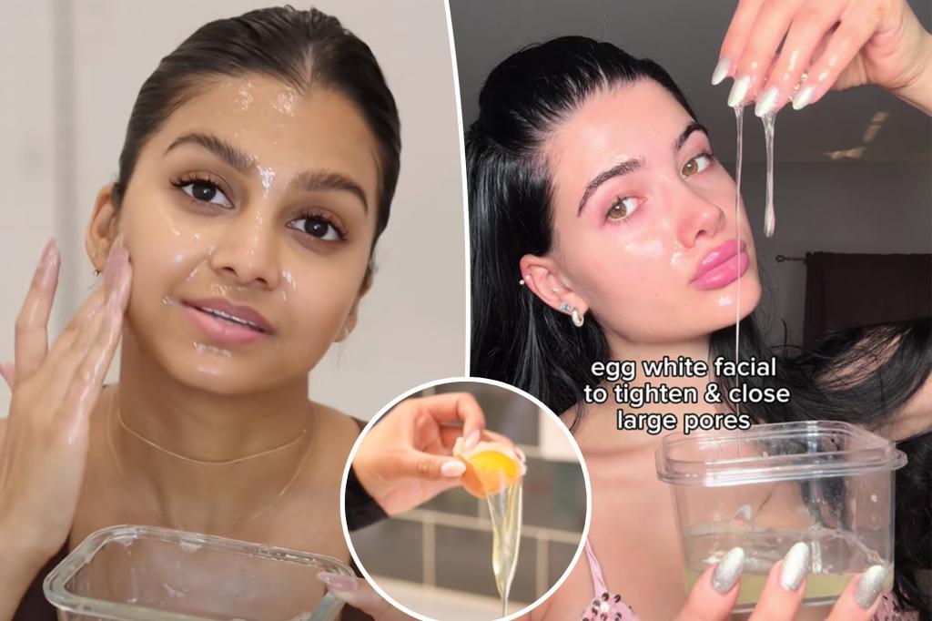 Egg-white facials are a controversial, viral skin trend, bird flu be damned — but experts have a big warning about it