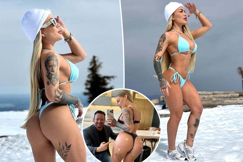 Influencer’s sexy photoshoot lands her in the ER: ‘My butt was completely numb — I couldn’t even sit’