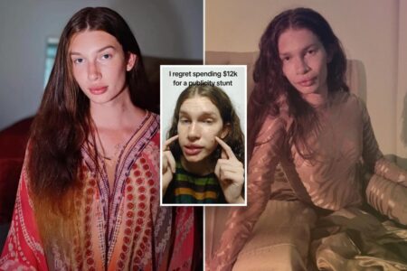 I regret $8K procedures to transform into a cat — the dumb publicity stunt was excruciating