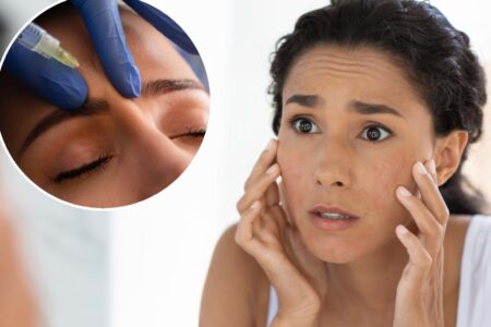 These budget-friendly Botox ‘hacks’ can take years off your face, expert says