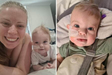 Baby born with rare genetic disorder undergoes eight surgeries in 18 months: ‘You have to just be strong for him’