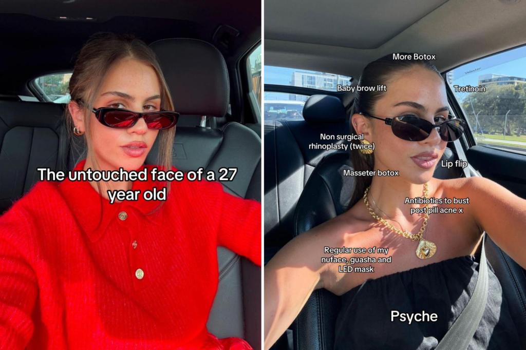 Inside Gen Z’s obsession with ‘tweakments’ — the plastic surgery trend to create a natural beauty look