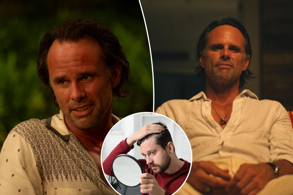 Receding hairlines are suddenly sexy — thanks to ‘White Lotus’ hunk Walton Goggins