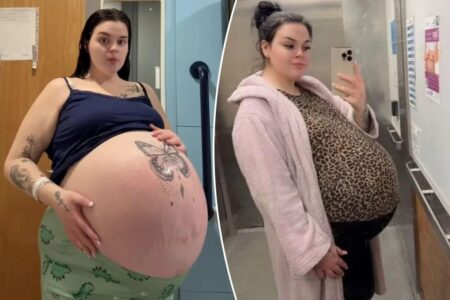 I had a condition that caused an oversized baby bump — people joked I was carrying a ‘penthouse’