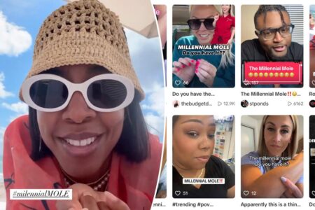 Is the ‘millennial mole’ real? Generation makes strange claim they all have the same mysterious beauty mark