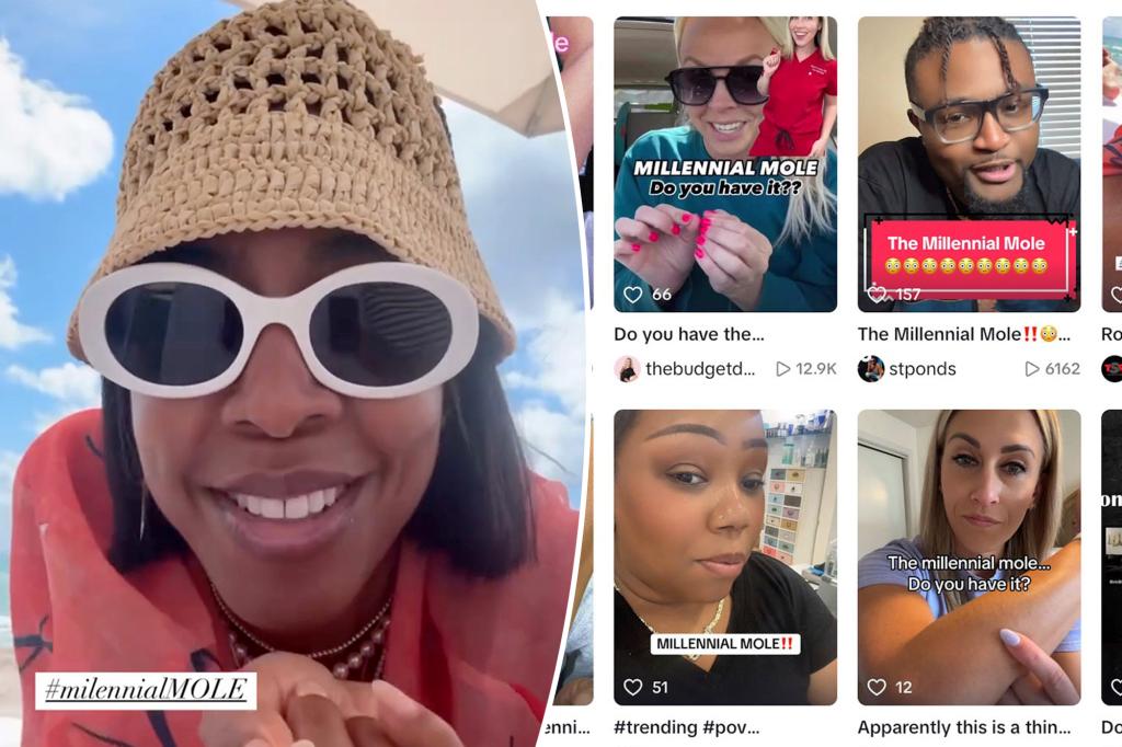 Is the ‘millennial mole’ real? Generation makes strange claim they all have the same mysterious beauty mark
