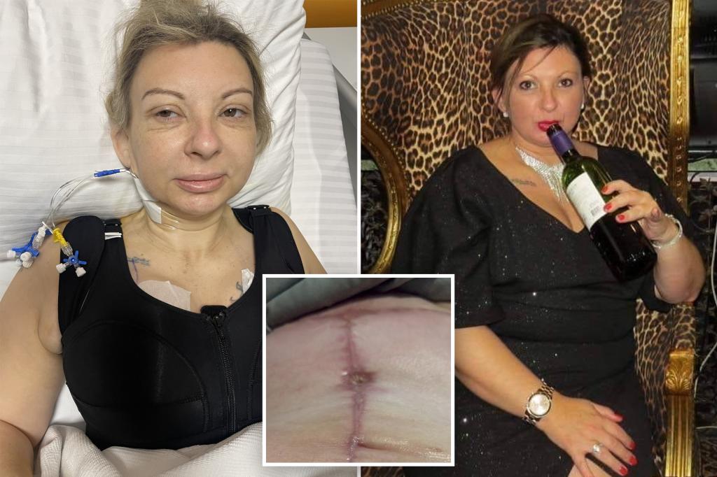 I spent over $9K on a ‘mommy makeover’ in Turkey — it’s my life’s ‘biggest regret’