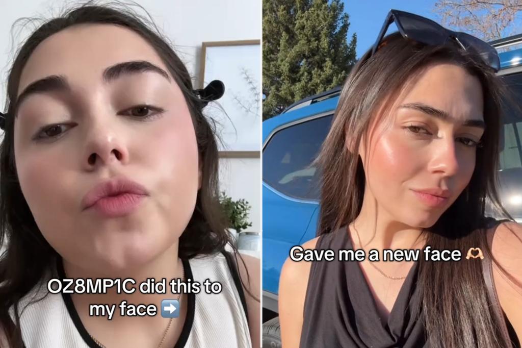 ‘Ozempic face’ might cause sagging skin — but one user loves her new look: ‘Like I got jawline filler’