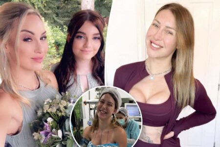 I paid over $160K to reverse my ‘Barbie doll’ surgeries — and finally look like my kids again