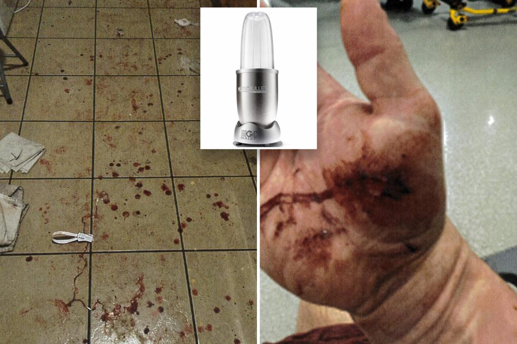 Exploding Nutribullet left NYC man with severed artery, ‘trauma that will last a lifetime’: lawsuit