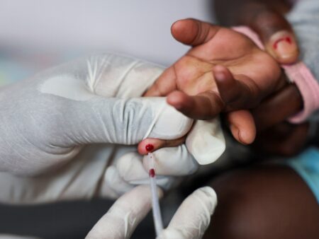 US aid cuts could lead to millions more HIV/AIDS deaths by 2029, UN warns