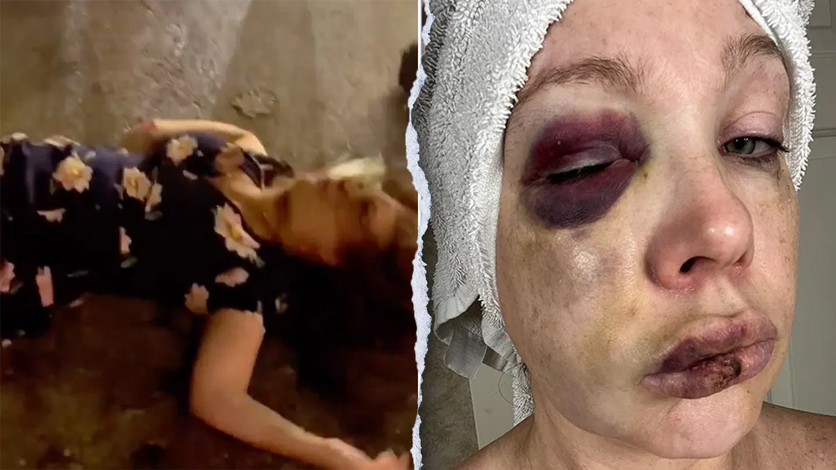 cincinnati beating victim on ground, left; closeup shot right