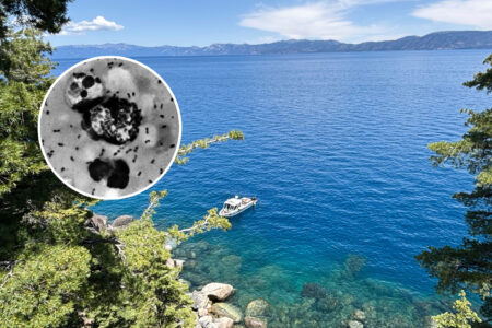 California Resident Catches Plague – Newsweek