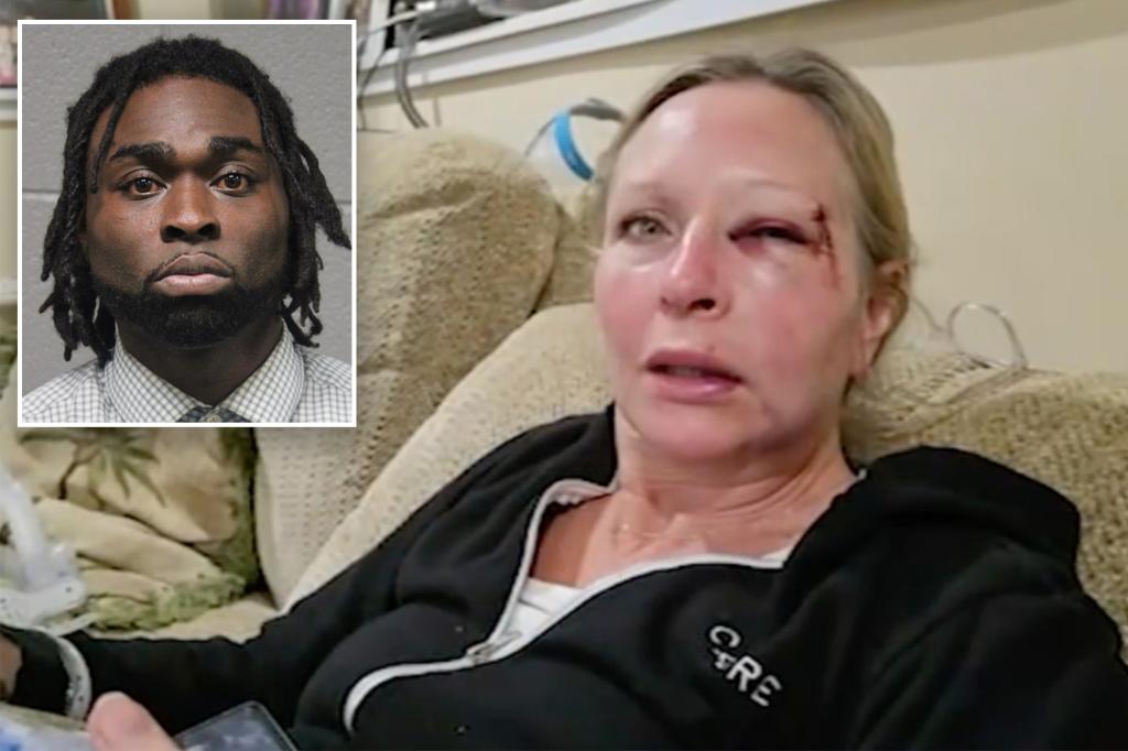 Chicago mother knocked out by career criminal in random attack — as Trump prepares to send in National Guard