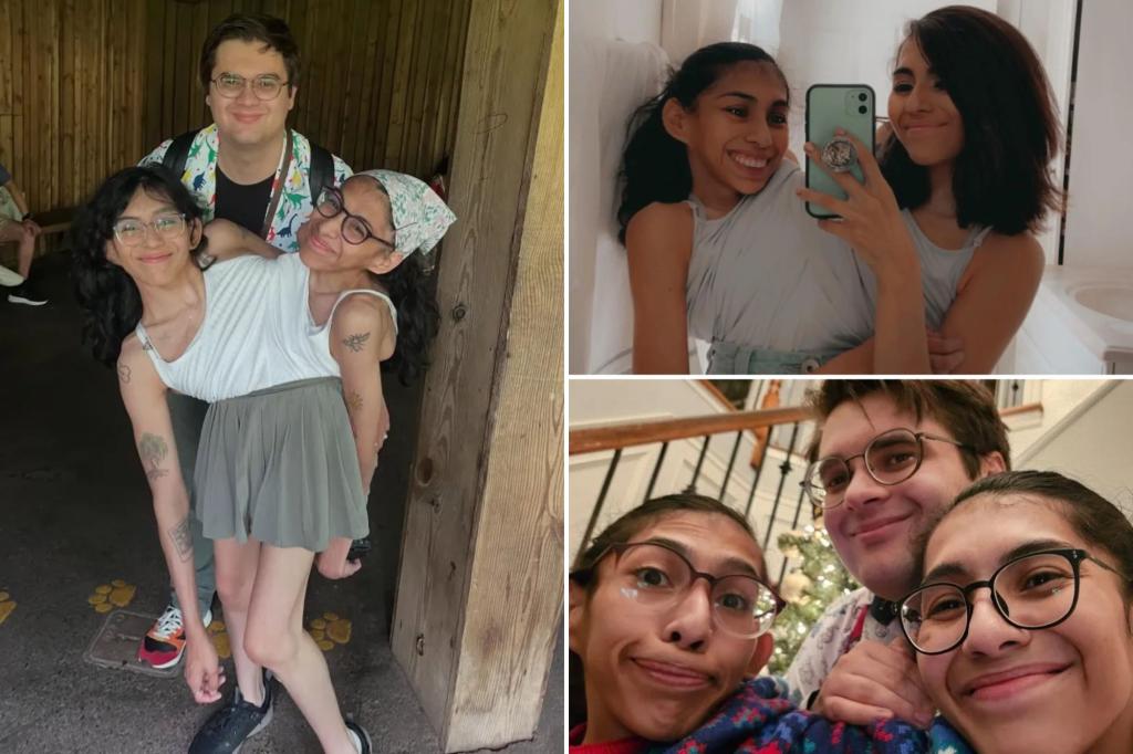 Married conjoined twin tackles question everyone wants to know: ‘People are obsessed with sex’