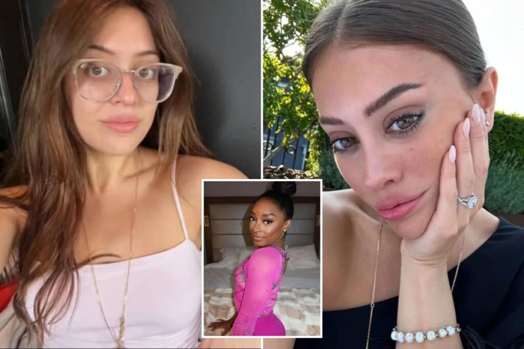 Exclusive | Simone Biles’ plastic surgery spotlights rise of women under 30 having major work done: ‘Seismic shift’