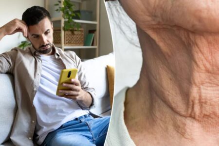 The sneaky way your phone is aging you — it’s ‘becoming more prevalent’ in younger patients