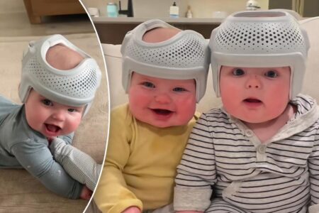 My twin babies wear $700 helmets for 23 hours a day to reshape their flat heads — haters say I’m ‘crazy,’ but it’s for their own good