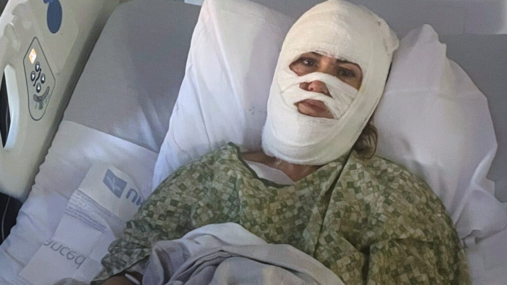 Georgia woman hospitalized after attacker hurls corrosive chemical during evening walk