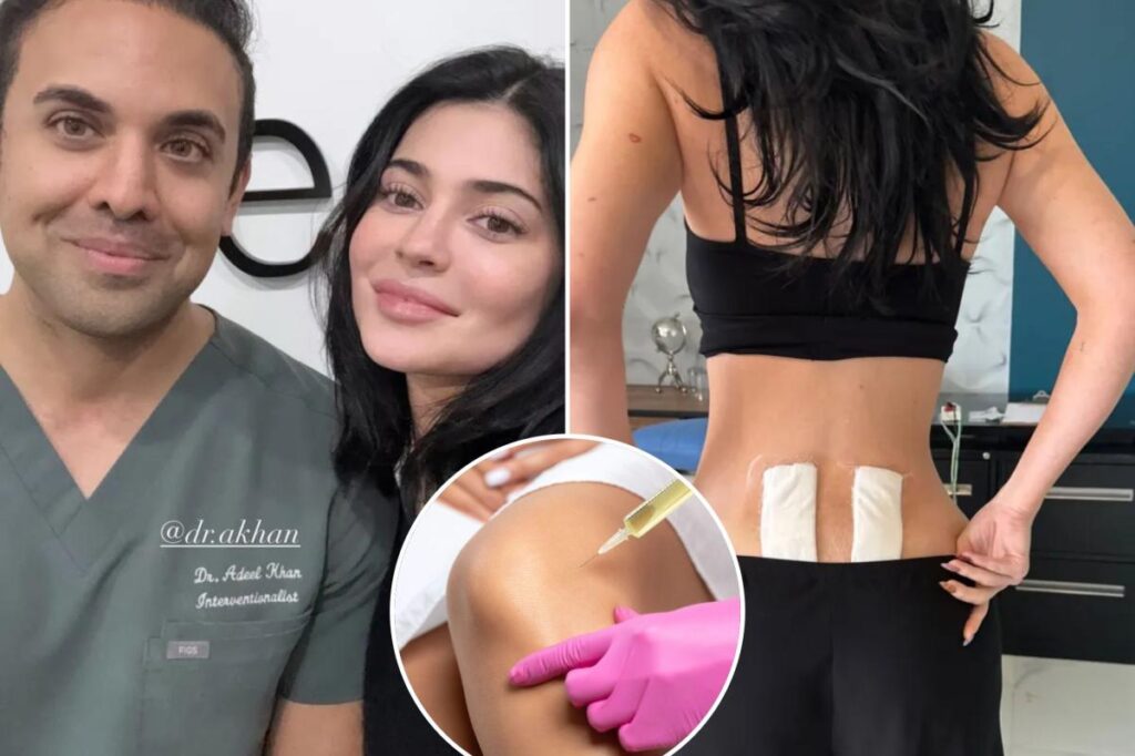 What is stem cell therapy? Kylie Jenner reveals treatment for chronic back pain she had to fly to Mexico for