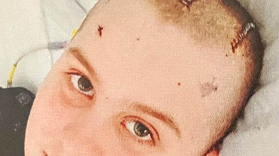 Max Shearer was just 11 years old when doctors discovered a rare form of brain cancer.