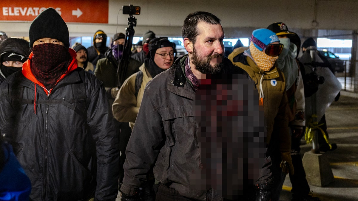 Alleged white nationalist being followed by protesters and media with blurs covering blood