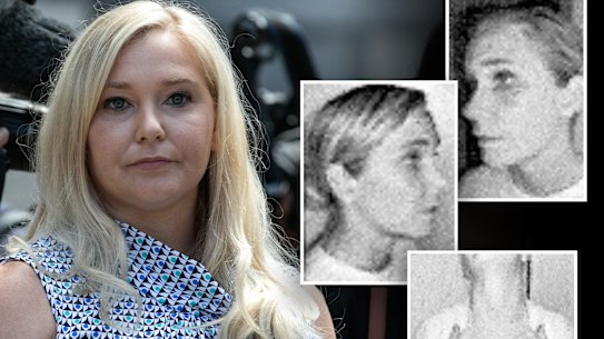 Virginia Giuffre’s injuries from a domestic violence assault by her then-husband Robert Giuffre in Colorado in 2015.  