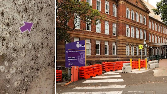 Mould uncovered at Sydney’s RPA Hospital.