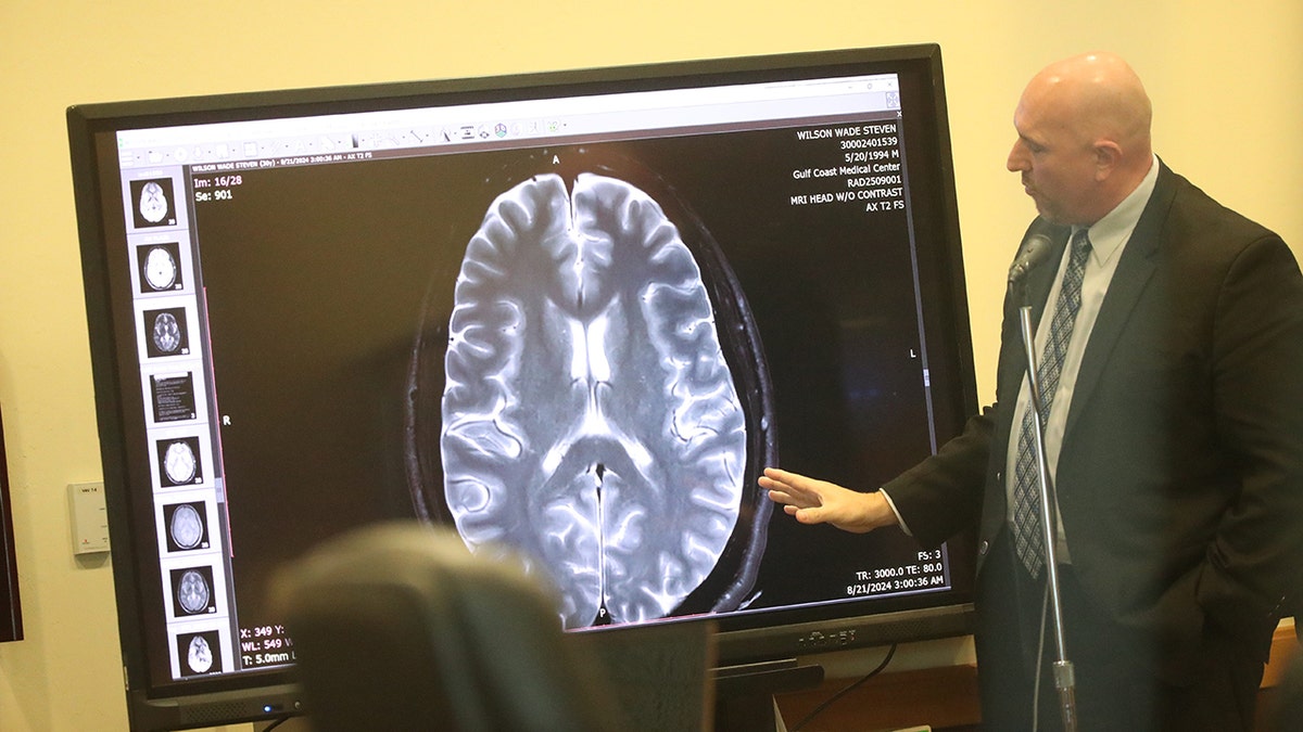 Wade Wilson's brain scan being shown in court.